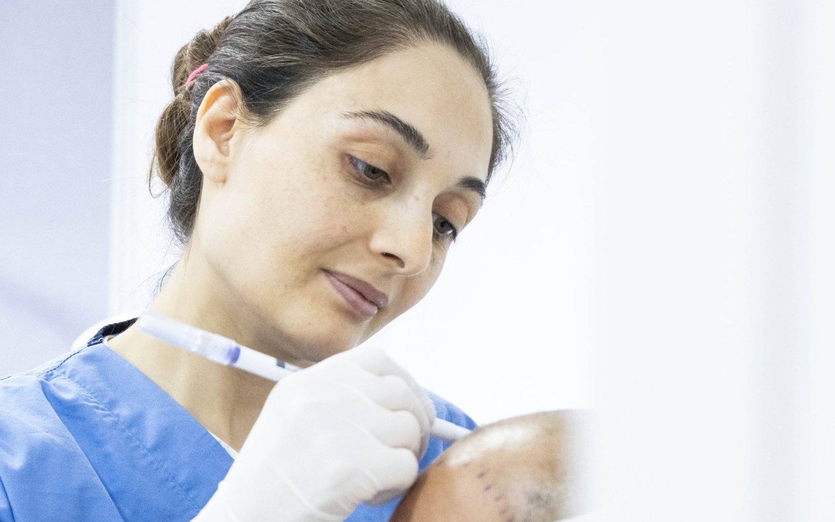 Carla Clinic saç çizgisi analizi — klinik görseli