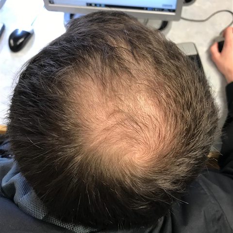 Tepe bölgesi örnek fotoğraf
